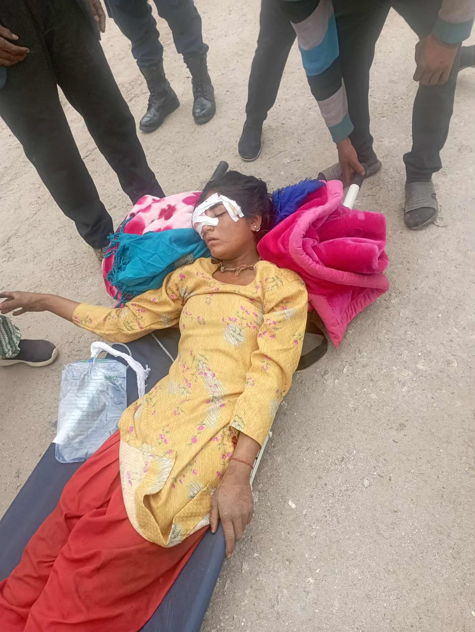 बाटो खन्ने क्रममा घाइते भएकी बिकलाई नेपालगञ्ज रिफर ।